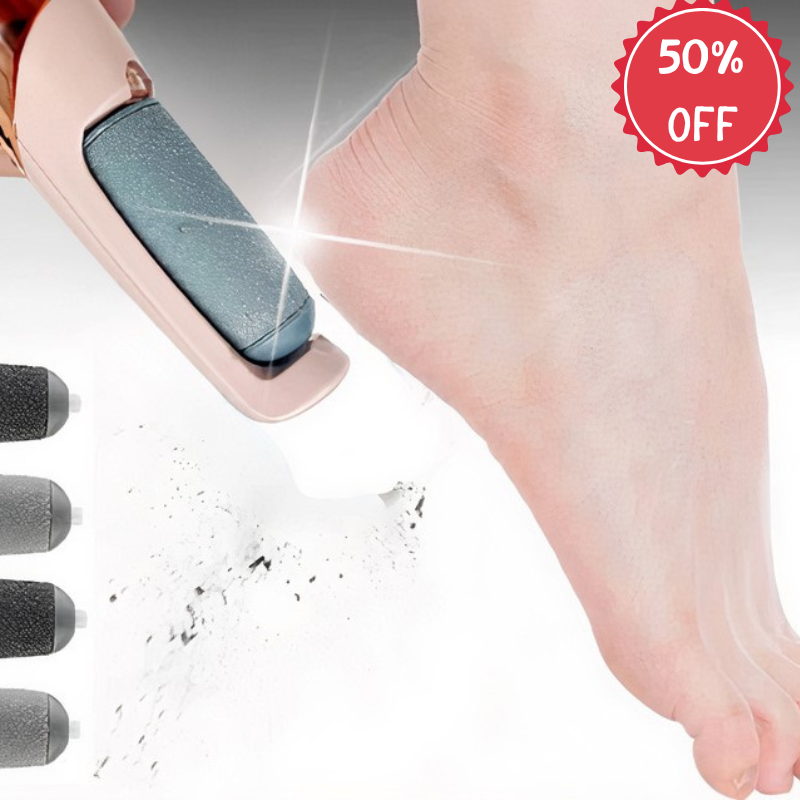 Rechargeable foot callus remover